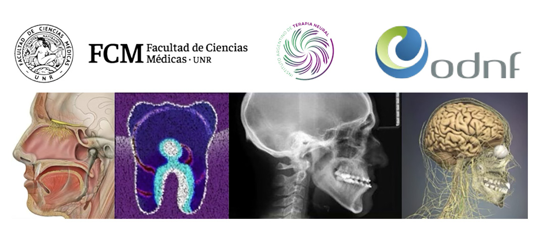 CURSO UNIVERSITARIO AVANZADO DE<br />
ODONTOLOGÍA NEUROFOCAL