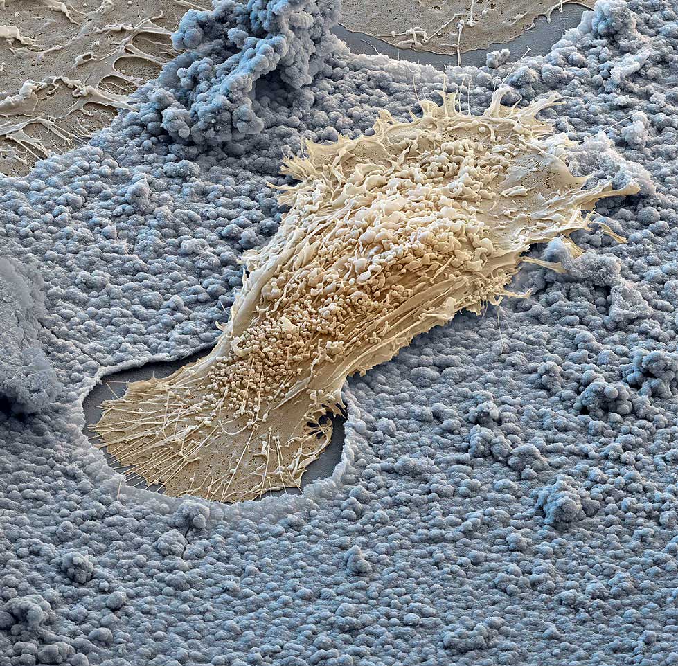 CURSO UNIVERSITARIO AVANZADO DE ODONTOLOGÍA NEUROFOCAL