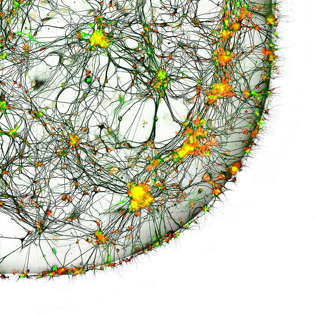 MEDICINA NEURALTERAPÉUTICA